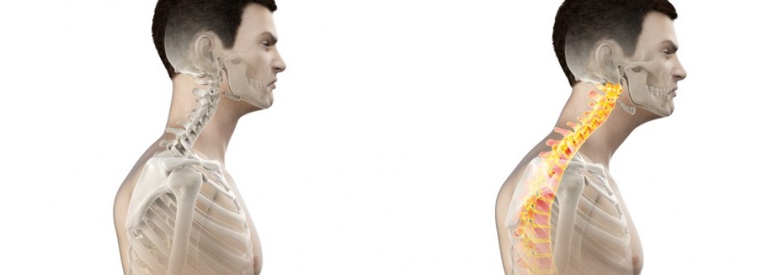 Tech Neck: Πως θα αποφύγεις την κακή στάση του σώματος όταν χρησιμοποιείς το κινητό