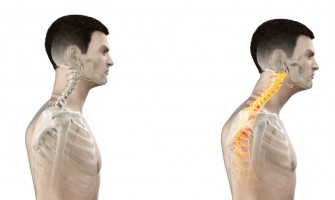 Tech Neck: Πως θα αποφύγεις την κακή στάση του σώματος όταν χρησιμοποιείς το κινητό