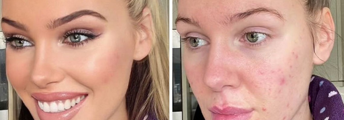 ΤικΤοκ: Νέο φίλτρο αναδεικνύει την φυσική ομορφιά